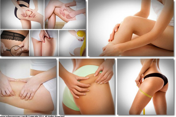 How to Get Rid of Cellulite Fast and Naturally