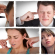 Tinnitus Treatment Natural – Treatments For Tinnitus That Really Work