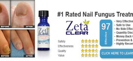 ZetaClear Reviews Nail Fungus Treatment – Does Zetaclear Really Work?