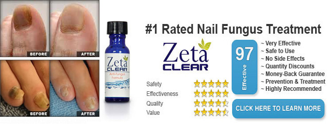 ZetaClear Reviews Nail Fungus Treatment - Does Zetaclear Really Work?