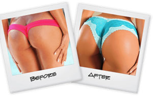 How To Make Your Buttocks Bigger In A Week