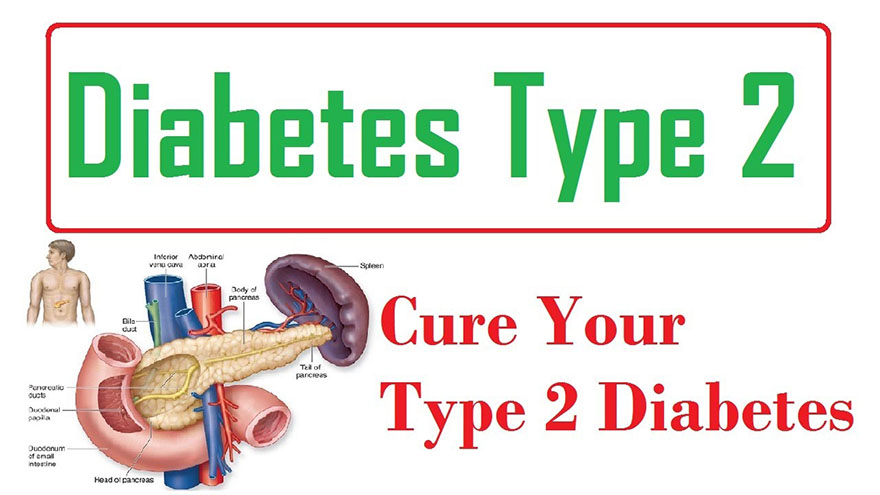 Can You Get Rid Of Type 2 Diabetes Naturally