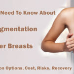 Breast Augmentation For Larger Breasts